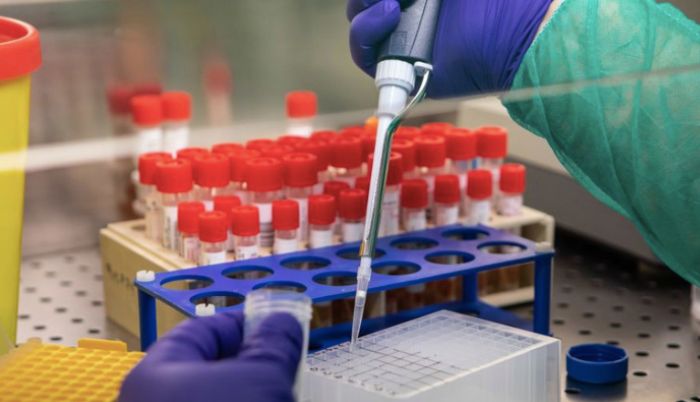 BREAKING NEWS: Ghana Records Two Coronavirus Cases – Health Minister